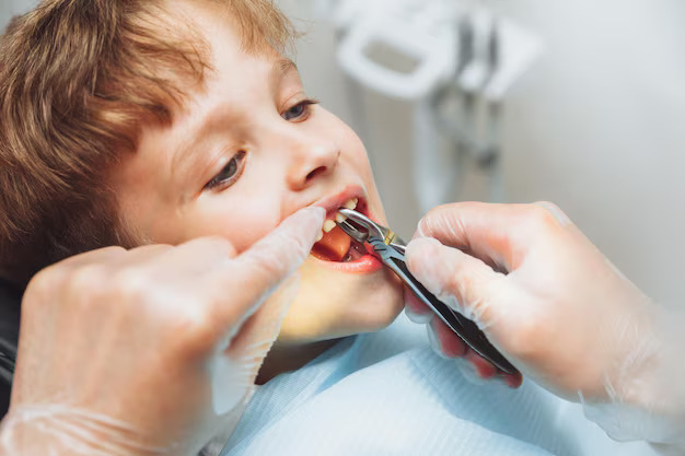 Pediatric Tooth Extractions: What Every Parent Needs to Know